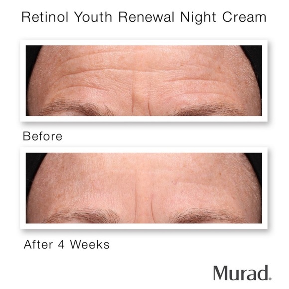 🌻Murad Retinol Youth Renewal Night Cream - Travel-sized - Picture 5 of 14